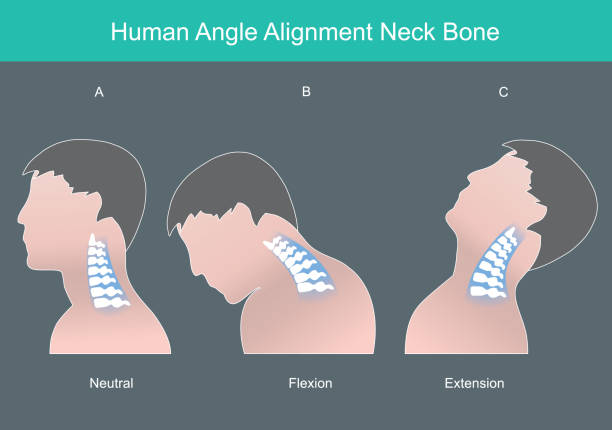 Human angle alignment neck bone. Human neck bone in correct angles. Illustration infographic."n vector art illustration