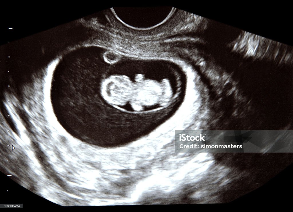 Wczesnej ciąży skanowania - Zbiór zdjęć royalty-free (Ultradźwięk)