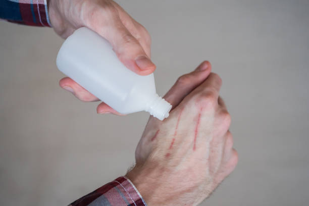 Man trying to treat cat scratches with cotton pad and hydrogen peroxide Close up view of man hand trying to treat cat scratches on skin with hydrogen peroxide in plastic bottl. First aid, disinfect, healthcare, treatment and medicine concept hydrogen peroxide stock pictures, royalty-free photos & images