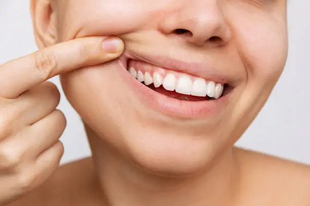 Photo of Gum health. Cropped shot of a young woman showing healthy gums