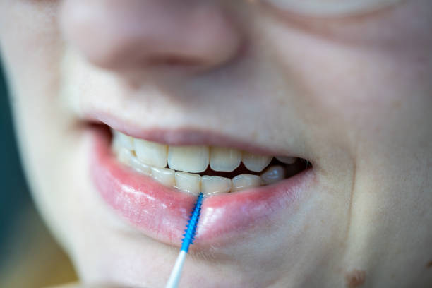 口の中のプラスチック爪楊枝 - floss toothpick ストックフォトと画像
