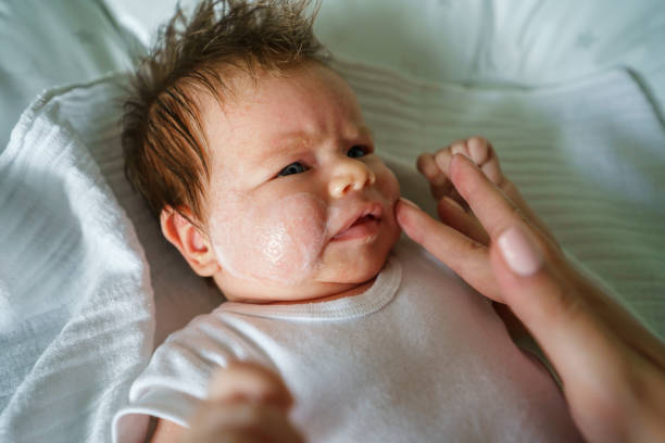 istock Neurodermatitis Chronic constitutional atopic eczema small newborn baby with dry skin problem on her face and hands of mother with medicine cream applying while lying on bed at home 1371344959