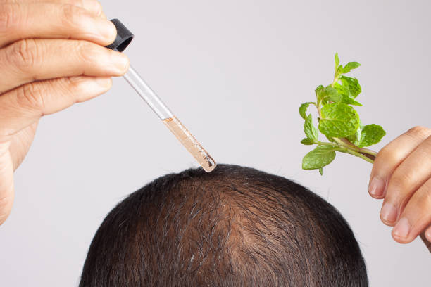 istock bald man using Peppermint essential hair oil in a dropper 1371352199