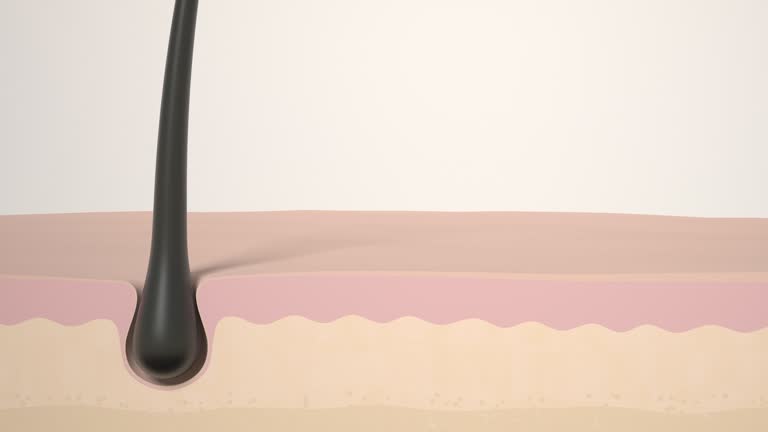 554 Hair Follicle Stock Videos and Royalty-Free Footage - iStock | Hair follicle close up, Hair follicle illustration, Human hair follicle 554 Hair Follicle Stock Videos and Royalty-Free Footage - iStock | Hair follicle close up, Hair follicle illustration, Human hair follicle