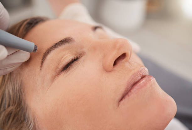 closeup shot of a mature woman enjoying a micro-needling treatment at a spa - ogen dicht closeup vrouw 50 jaar stockfoto's en -beelden