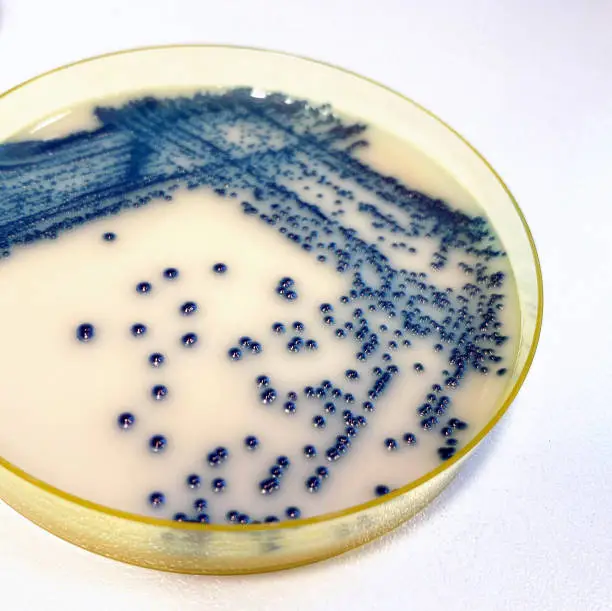 Candida is the most common fungal pathogen, with Candida albicans and Candida tropicalis accounting for 90% of the infections.