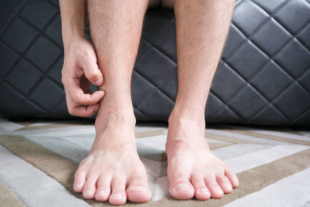 Men wear canvas shoes, he scratches legs and feet with itchy skin. Caused by  of shoes stock photo