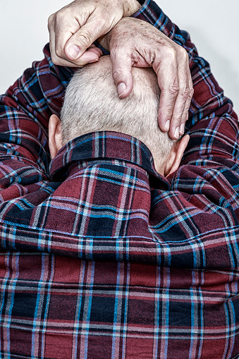 Rear back of head view of a distraught, frustrated senior adult man colorectal cancer patient currently undergoing chemotherapy and experiencing various chemo drug side effects. He is cradling his head with his hands and arms. Part of a 