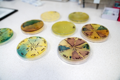 Different types in cell development glass dishes on desk. Group of Petri dishes with different culture media and micro organisms grown.