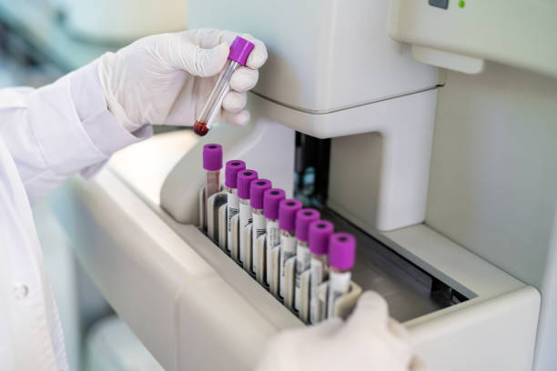 primer plano de los guantes de un médico trabajando en un laboratorio de pruebas - laboratory blood laboratory equipment medical sample fotografías e imágenes de stock