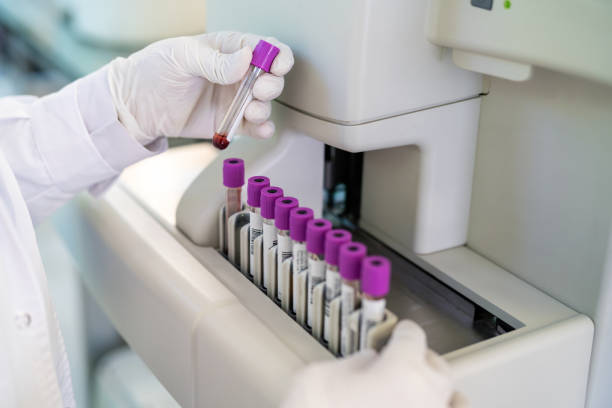 検査室で働く医師用手袋のクローズアップ - blood sample blood tube pathologist スト�ックフォトと画像