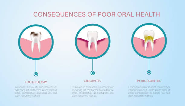 Consequences of poor oral health Consequences of poor oral hygiene, caries, gingivitis and periodontitis. toothbrush toothpaste backgrounds beauty stock illustrations