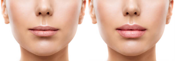 フィラーの前後の女性の唇。完全な唇と薄い唇の増強。女性の口永久的なメイクアップ白い背景の上にクローズアップ - female color image human head studio shot ストックフォトと画像