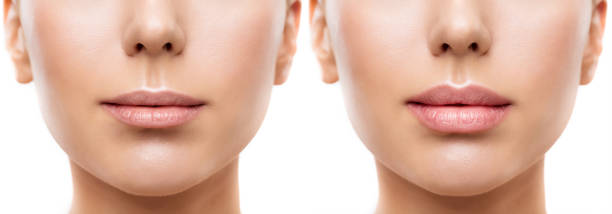 Woman Lips before and after Fillers. Full Lip and Thin Lip Augmentation. Women Mouth Permanent Make up Close up over White Background Woman Lips before and after Fillers. Full Lip and Thin Lip Augmentation. Women Mouth Permanent Make up Close up over White Isolated Background human lips stock pictures, royalty-free photos & images