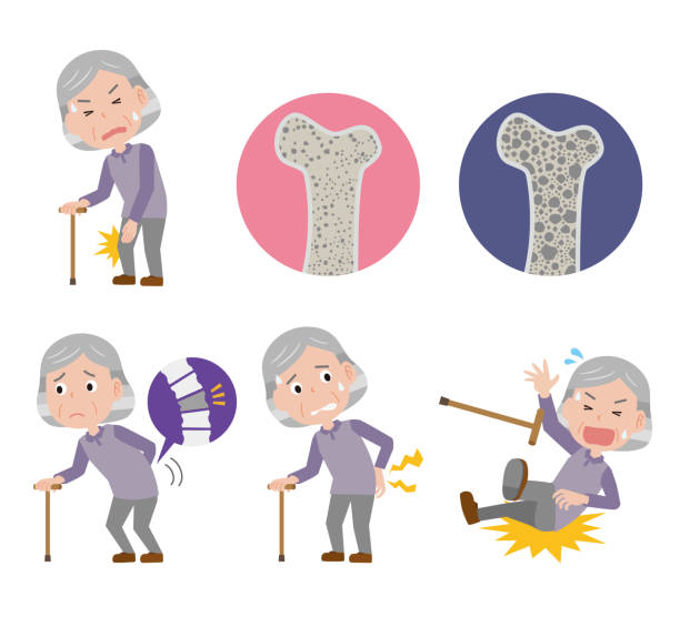 illustrazioni stock, clip art, cartoni animati e icone di tendenza di immagine di una donna anziana con osteoporosi 2 - falling people tripping senior adult