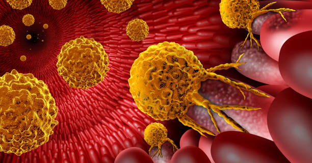 istock Inner Intestine Cancer 1371970746