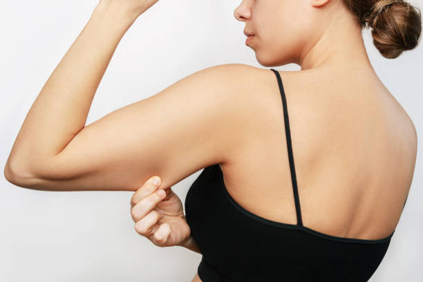 young woman grabbing skin on her upper arm with excess fat. pinching the loose saggy muscles - loose weight imagens e fotografias de stock