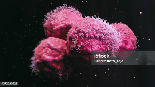 Cancer Malignant Cells Stock Photo - Download Image Now - Cancer Cell, Cancer - Illness, Lung Cancer