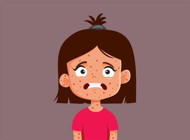 Little Girl Suffering from Measles Vector Cartoon Illustration Little kid getting a viral disease suffering from the symptoms measles illustrations stock illustrations