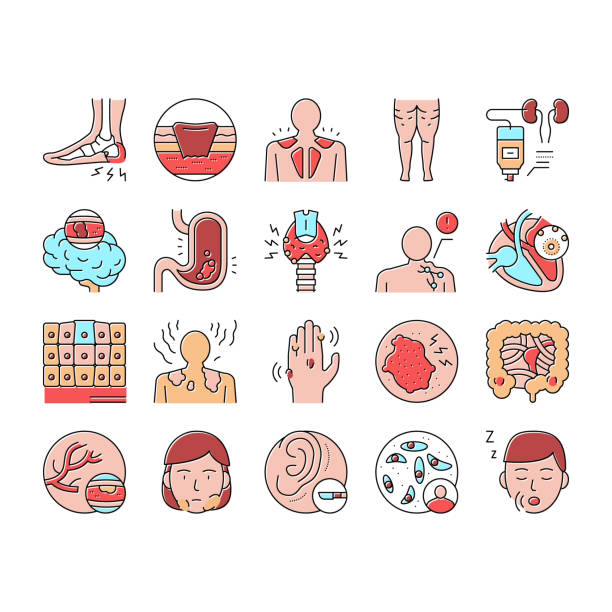 Disease Human Problem Collection Icons Set Vector . Disease Human Problem Collection Icons Set Vector. Epithelial Tissue And Toxoplasmosis, Ear Surgery And Cellulite, Skin Itch And Lymphoma Disease Concept Linear Pictograms. Contour Illustrations . salivary gland surgery stock illustrations