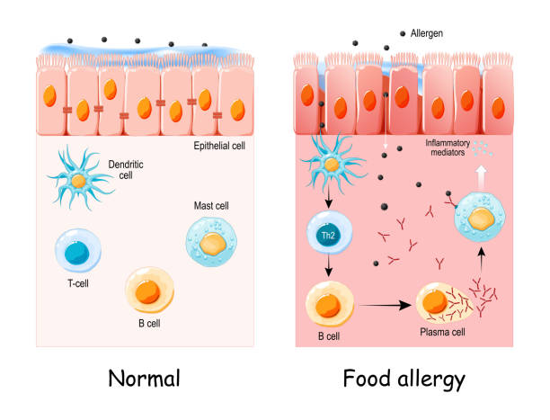 food allergy.  development of an allergic reaction vector art illustration