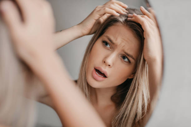 Frustrated woman searching hair flakes suffering from dandruff problem, looking at her reflection in mirror in bathroom Frustrated woman searching hair flakes suffering from dandruff problem, looking at her reflection in mirror in bathroom. Haircare and head skin health concept dandruff stock pictures, royalty-free photos & images