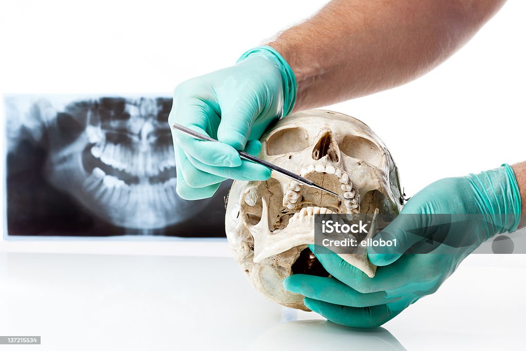 caries dentaires dentiste montrant un Crâne humain. - Photo de Adulte libre de droits
