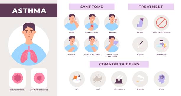 Asthma disease infographic with symptoms, treatment and common triggers. Man with cough, wheezing and dyspnea. Breath difficulty vector info Asthma disease infographic with symptoms, treatment and common triggers. Man with cough, wheezing and dyspnea. Breath difficulty vector info. Illustration of medical asthma and treatment asma stock illustrations