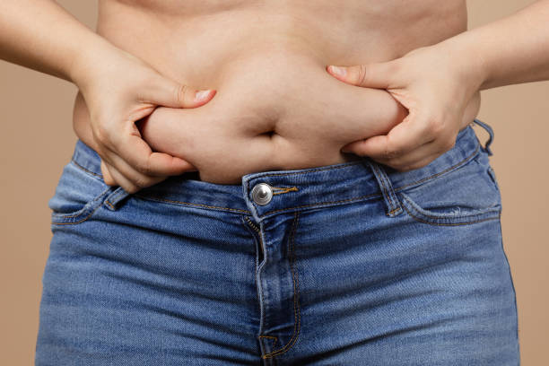 青いジーンズをはいた手で太りすぎの腹に触れる白人の太った女性。内臓脂肪。体のポジティブと自分自身を受け入れます。突然の体重増加。タイトな小さな服。ワードローブの変更の必要� - abdomen too small jeans overweight ストックフォトと画像