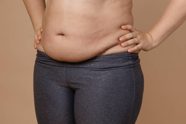 Front view of overweighted thick belly of woman wearing leggings. Body positive. Violation of cell elasticity, loss of nutrients. Sagging skin after pregnancy or sudden weight loss Front view of overweighted thick belly of woman wearing leggings. Body positive. Violation of cell elasticity, loss of nutrients. Sagging skin after pregnancy or sudden weight loss. drooping stock pictures, royalty-free photos & images