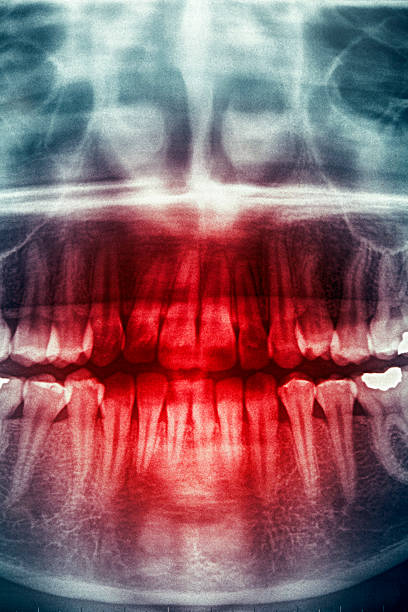 istock Dental X-Ray, horror skull 137234561