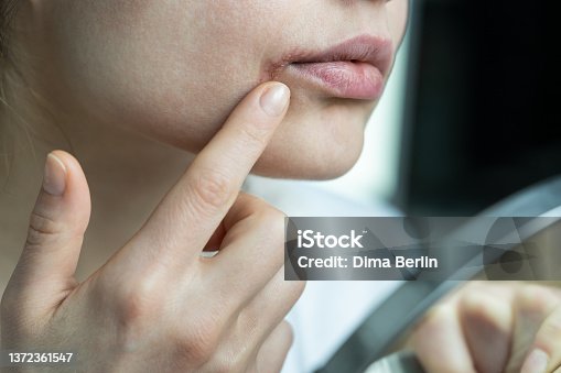 istock Girl applying lip balm with finger to prevent dryness and chapping in cold season, looking at mirror 1372361547