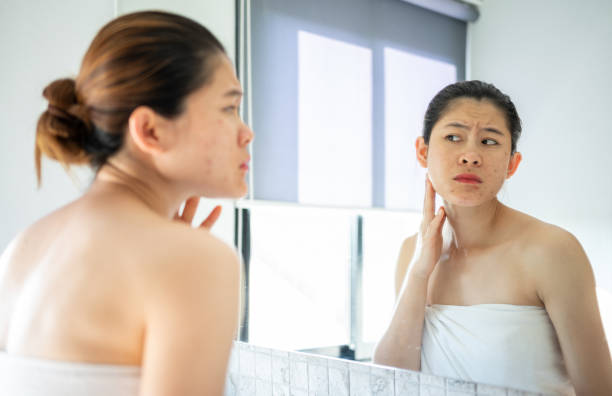 istock Asian woman feeling stress after looking her face in mirror. 1372441738