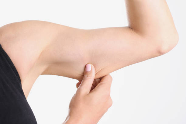 istock A young woman pulls the skin on her arm, close-up 1372522324