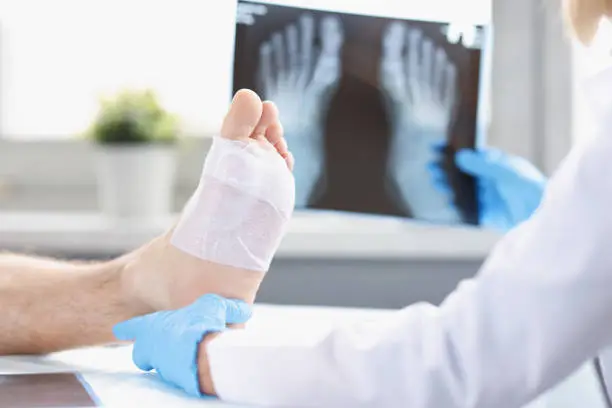 Photo of A doctor looks at an x-ray of a man's injured leg, blurry