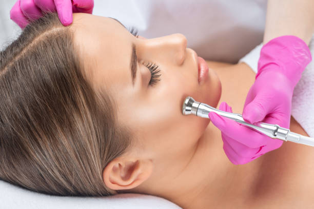 cosmetologo fa procedura microdermabrasion sul viso contro acne e punti neri vicino agli occhi. cosmetologia femminile nel salone di bellezza. - dermatology dermabrasion surgery medical foto e immagini stock