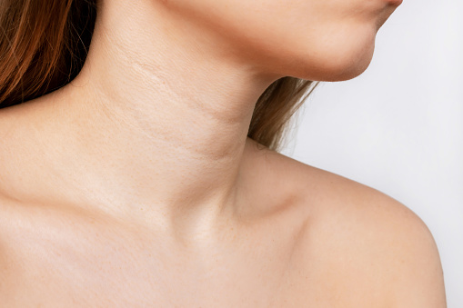 Сropped shot of a young woman with lines on the neck isolated on a white background. Wrinkles, creases, age-related changes, rings of Venus. Skin care
