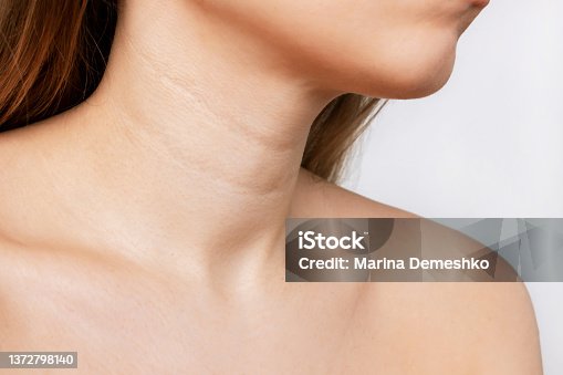 istock Cropped shot of a young woman with lines on her neck Wrinkles creases agerelated changes 1372798140