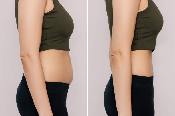 A woman with belly with excess fat and toned slim stomach with abs before and after losing weight Two shots of a woman in profile with a belly with excess fat and toned slim stomach with abs before and after losing weight isolated on a beige background. Result of diet, liposuction, training before and after weight loss stock pictures, royalty-free photos & images