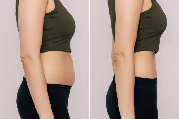 A woman with belly with excess fat and toned slim stomach with abs before and after losing weight Two shots of a woman in profile with a belly with excess fat and toned slim stomach with abs before and after losing weight isolated on a beige background. Result of diet, liposuction, training slim stock pictures, royalty-free photos & images