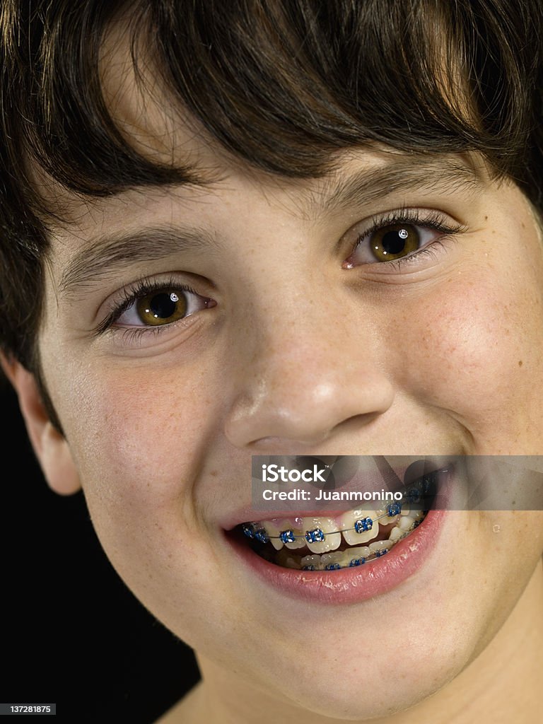 Wyświetlanie jego Aparat ortodontyczny - Zbiór zdjęć royalty-free (10-11 lat)