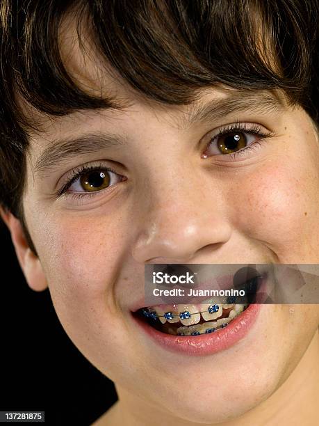 Wyświetlanie Jego Aparat Ortodontyczny - zdjęcia stockowe i więcej obrazów 10-11 lat - 10-11 lat, Aparat ortodontyczny, Bliskie zbliżenie