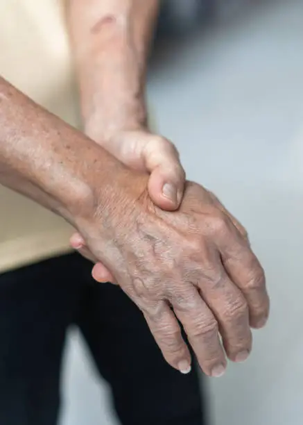 Photo of Guillain-Barre Syndrome GBS, Peripheral Neuropathy pain in elderly patient on hand, fingers, sensory nerves with numb, muscle weakness from chronic inflammatory demyelinating polyneuropathy