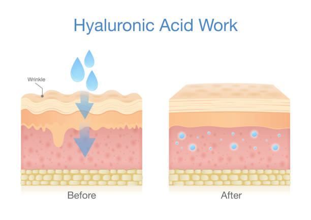 ヒアルロン酸を得る皮膚層は、肌の水分を増加させ、細かい線やしわの外観を減少させます。 - ヒアルロン酸点のイラスト素材／クリップアート素材／マンガ素材／アイコン素材