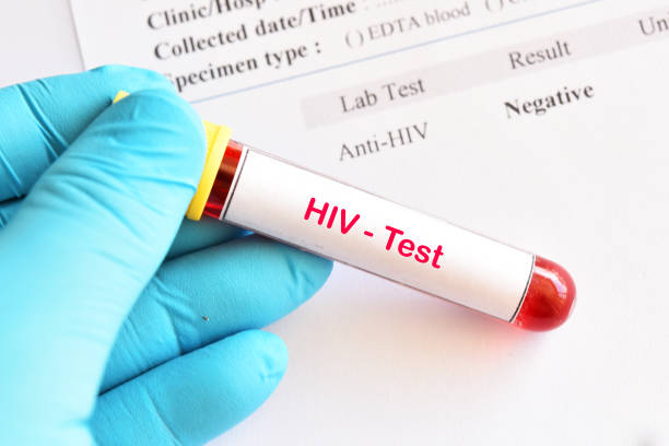 HIV negative test result HIV negative test result with blood sample tube hiv stock pictures, royalty-free photos & images