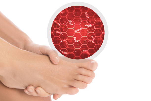 真菌の影響を受ける女性の足 - fungus toenail human foot onychomycosis ストックフォトと画像
