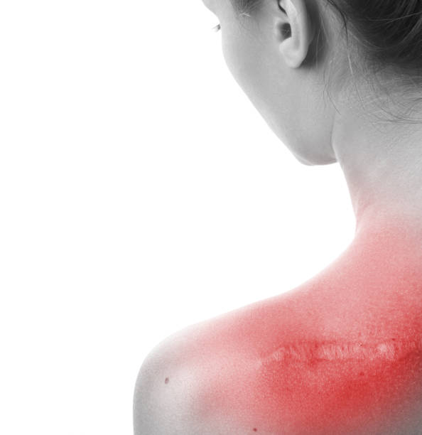 istock Woman with a scar on her shoulder 1373154035