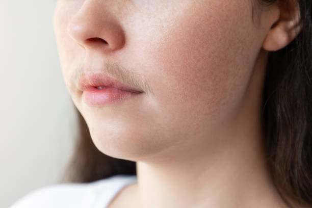 A close-up of a woman's face with a mustache over her upper lip. The concept of hair removal and epilation A close-up of a woman's face with a mustache over her upper lip. The concept of hair removal and epilation. moustache stock pictures, royalty-free photos & images