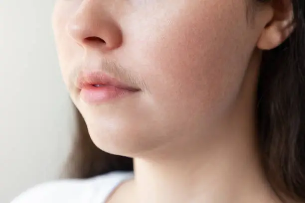 Photo of A close-up of a woman's face with a mustache over her upper lip. The concept of hair removal and epilation