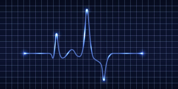 Heart beat pulse monitor, blue electric wave signal, oscilloscope graph. Electrocardiogram line graph with light glow effect. Technology vVector illustration Heart beat pulse monitor, blue electric wave signal, oscilloscope graph. Electrocardiogram line graph with light glow effect. Technology vVector illustration stress test stock illustrations